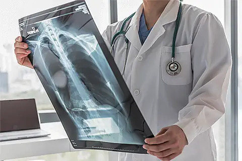 Respiratory Disease